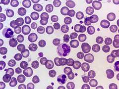 
      
      Scientists found mutations in gene causing obesity 
      
      