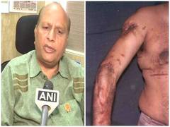 
      
      Mumbai serial blast case: Victim Kirti Ajmera moves NHRC,...
      
      