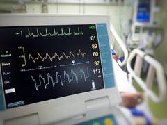 
      
      Study: Close monitoring for heart risk needed if breast,...
      
      
