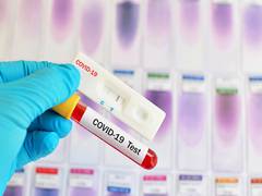 
      
      Russia's COVID-19 case tally surpasses 5 million
      
      