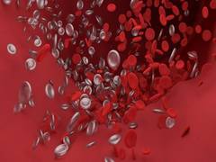 
      
      Study examines effects of exercise, age effects on plaque...
      
      