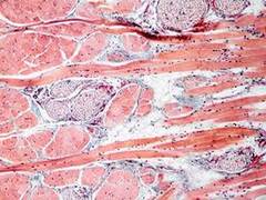 
      
      Study reveals how skin cells prepare to heal wounds
      
      