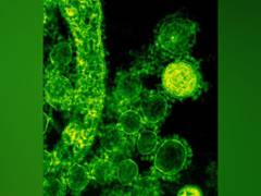 
      
      Study reveals that immune cells cooperate to kill bacteria
      
      