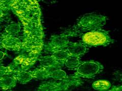 
      
      Researchers discover how bacteria adapt to new environment
      
      