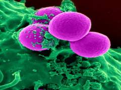 
      
      Bacteria could learn to predict future, study says
      
      