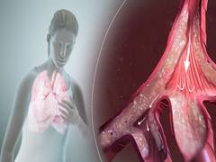
      
      Women with asthma have lower levels of testosterone: Study
      
      