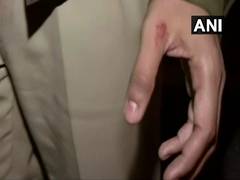 
      
       Protester bites cop during JNU protest in Delhi
      
      