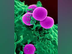 
      
      Research provides roadmap to HIV eradication via stem cell therapy
      
      