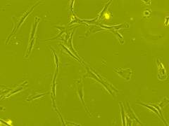 
      
      Drug-duo can potentially speed up bone healing process, find...
      
      