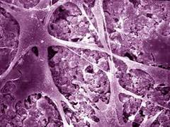 
      
      Biomaterial mimicking muscles can turn stem cells into bone
      
      