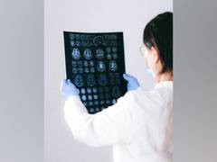 
      
      New super-resolution technique allows for more detailed brain...
      
      