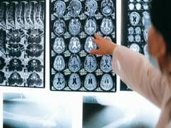 
      
      Researchers discover potential to reverse ageing in brain
      
      