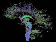 
      
      Transcranial electrical stimulation can boost memory: Study
      
      