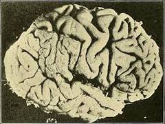 
      
      Aggressive brain tumour are reacting well to this new...
      
      