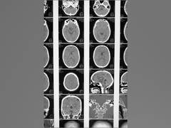 
      
      Research images bullet composition, implications for MRI safety
      
      