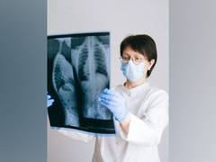 
      
      Study shares tips to protect lungs from damaged caused by TB
      
      