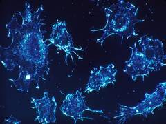
      
      Mortality due to cancer declines extensively, study shows
      
      