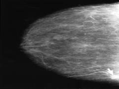 
      
      Google AI to make breast cancer diagnosis more accurate
      
      