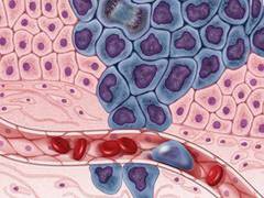 
      
      New keys found for unlocking head, neck cancer treatment
      
      