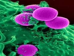 
      
      Study reveals how ecDNA forms, drives cancer drug resistance
      
      