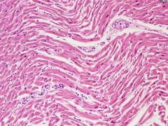 
      
      Switching the heart's fuel source can help its cells...
      
      