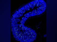 
      
      New discovery about immune 'sentinel' cells may aid cancer...
      
      