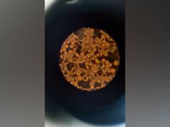 
      
      Gut cells get alert when parasites attack, says study
      
      