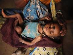
      
      Odisha: Month-long campaign to make state free from malnutrition
      
      