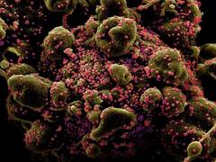 
      
      Gujarat reports 3 deaths, total 43 positive COVID-19 cases
      
      