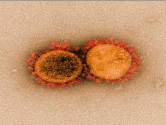 
      
      Coronavirus : Section 144 imposed in North Goa
      
      