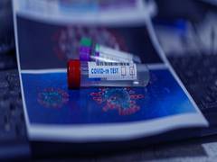 
      
      Study reveals blood tests can offer early indicator of severe...
      
      