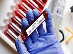
      
      More COVID cases should be tested for genome sequencing, says...
      
      