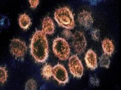 
      
      Seegene to export 1.7 million doses of COVID-19 test reagent...
      
      