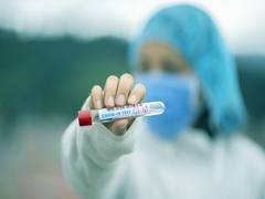 
      
      Study links 'COVID effect' to fewer heart surgeries, more...
      
      