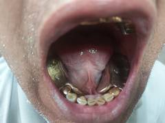 
      
      Two Uzbeki nationals hide 951-gram gold in mouth, nabbed at...
      
      