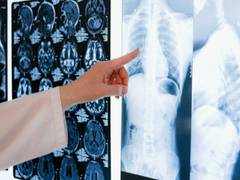
      
      Researchers attempt better understanding of cystic fibrosis
      
      