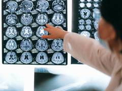 
      
      Newly discovered stem cell resting phase could put brain...
      
      