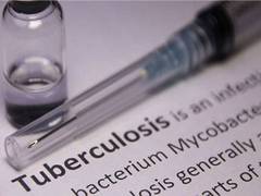 
      
      new effective therapeutic approaches to treat tuberculosis
      
      