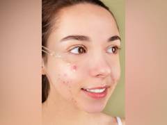 
      
      Fat cells in skin help fight acne: Study
      
      