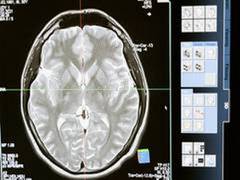 
      
      brain reactions to traumatic stress are associated with PTSD
      
      