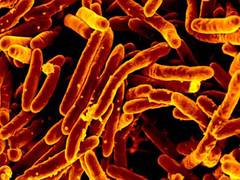 
      
      Tuberculosis infection is not life-long in most people: Study
      
      