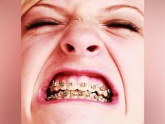 
      
      Braces might not always guarantee happiness 
      
      