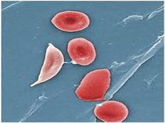 
      
      New study looks at post-COVID-19 emerging disease in children
      
      