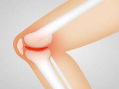 
      
      Vitamin D deficiency linked to poor muscle function in adults
      
      