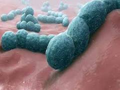 
      
      Risk factors for carrying pneumonia causing bacteria: Study 
      
      