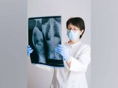 
      
      Potential biomarker for lung disease in scleroderma patients...
      
      