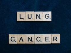 
      
      New model to predict patients with poor lung cancer outcomes
      
      