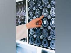 
      
      Redundant modular network supports proper brain...
      
      