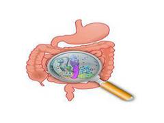 
      
      Small intestinal microbiome prevents obesity and type 2 diabetes
      
      
