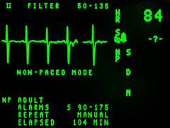 
      
      Increased heart rate associated with heightened risk of...
      
      
